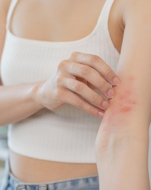 Salud & Belleza (Psoriasis)
